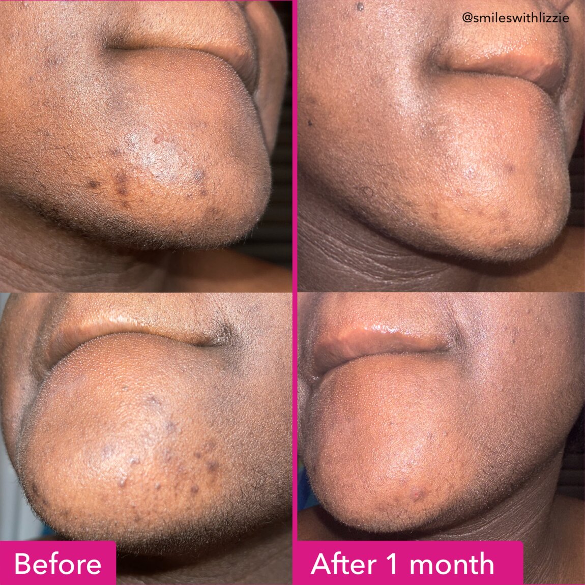 Good Molecules Brightening & Dark Spots Bar 85g - View 3