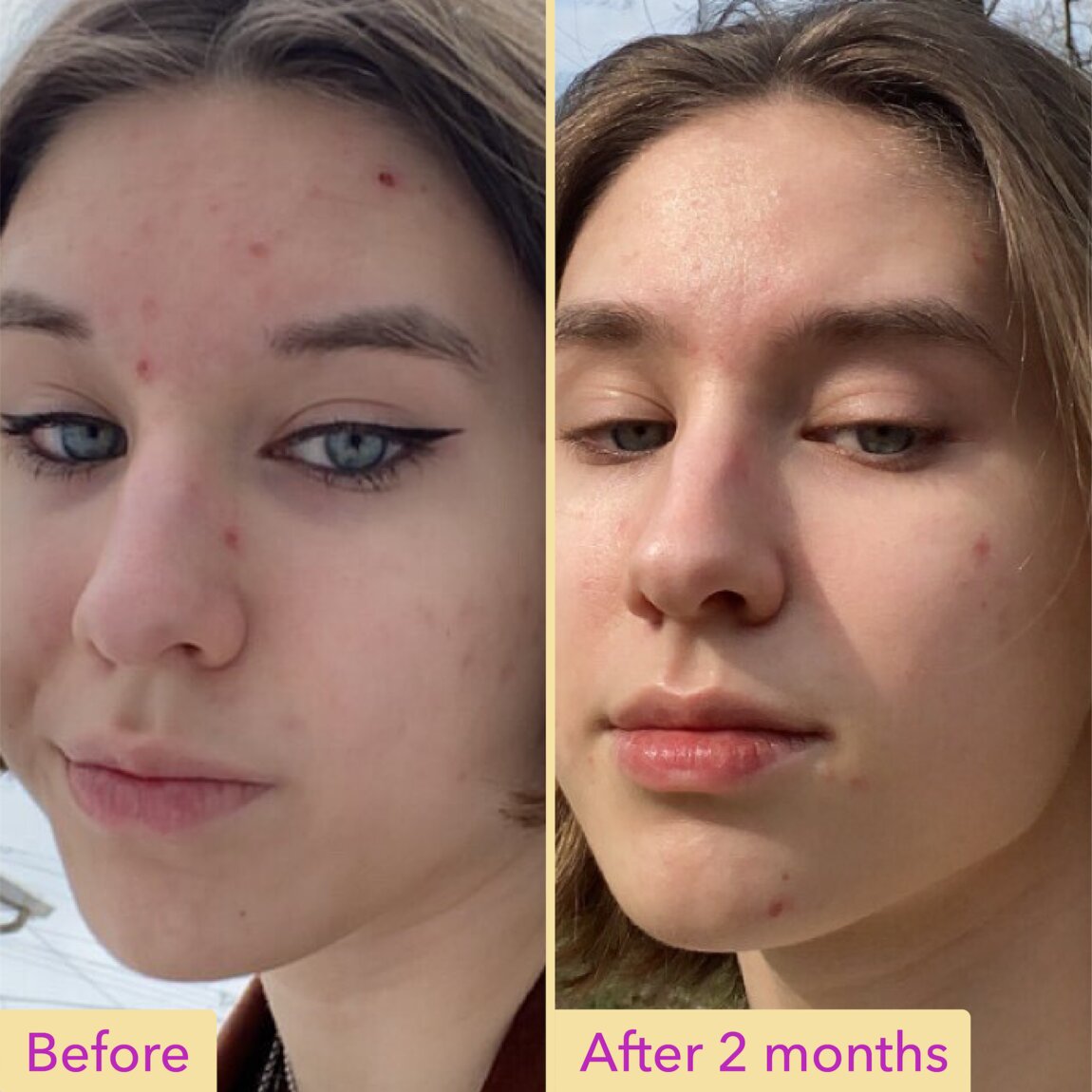 Good Molecules Niacinamide Serum 30ml - View 3