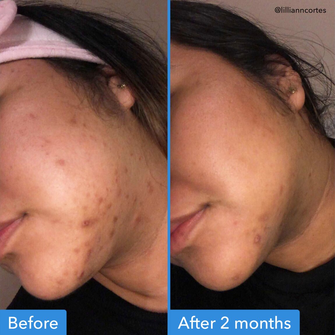 Good Molecules Discoloration Correcting Serum 30 ml - View 3
