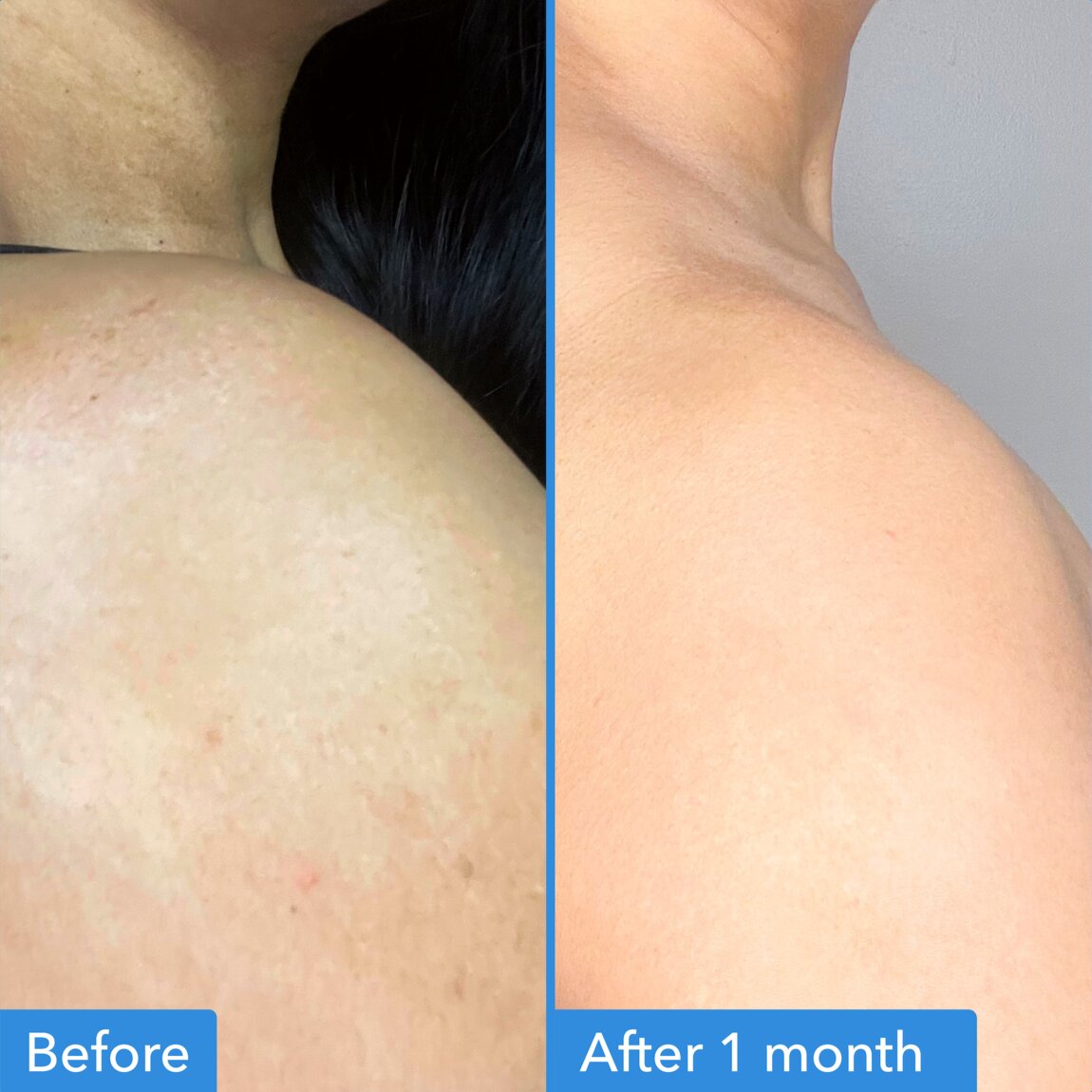 Good Molecules Discoloration Correcting Body Treatment 120ml - View 3