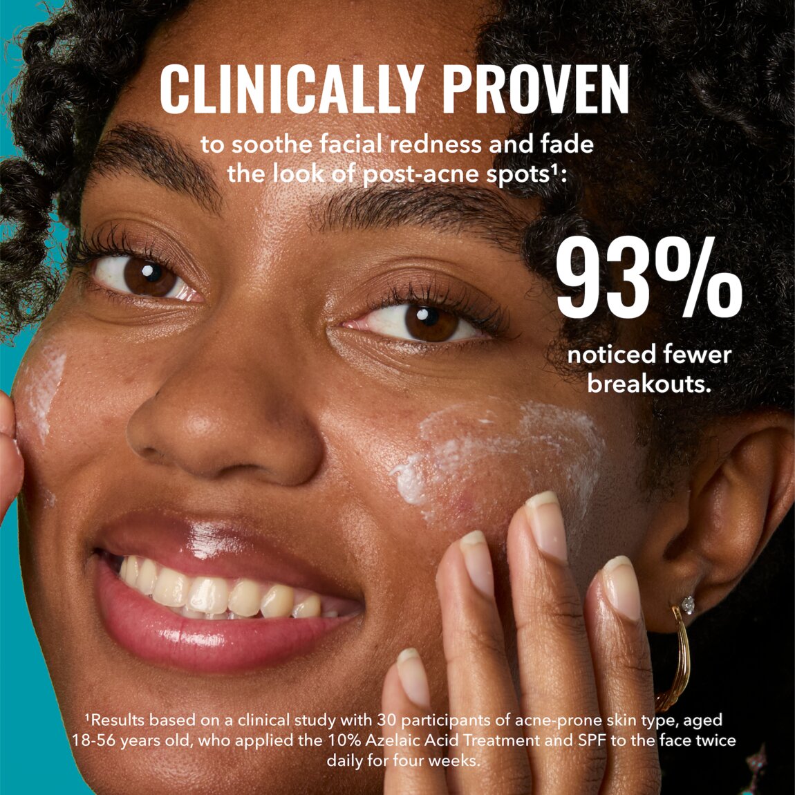 Good Molecules 10% Azelaic Acid Treatment 30ml - View 5